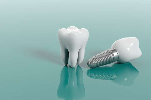 Dental Implant