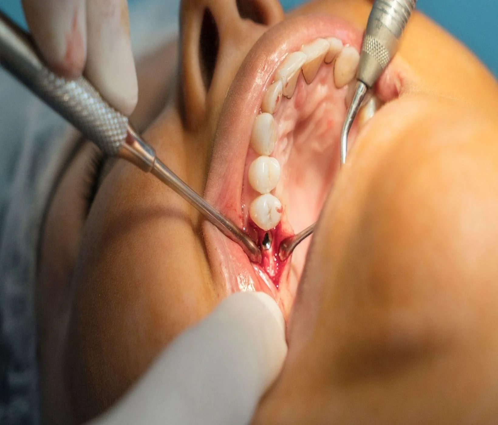Dental Surgery