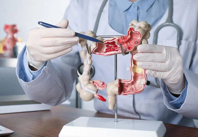 Endoscopy & Colonoscopy