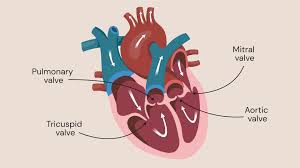 Heart Valve Complications