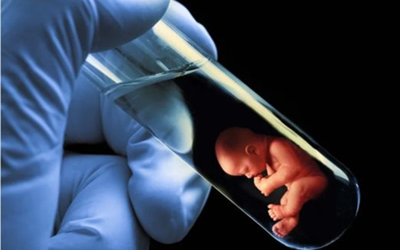 Test Tube Baby in Kolkata